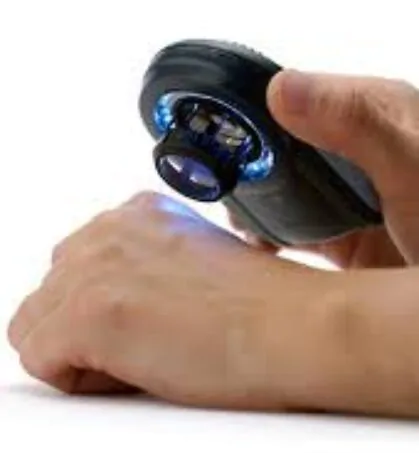 Dermatoscope